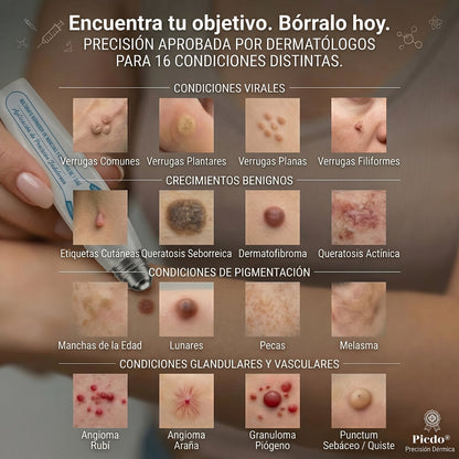 𝐏𝐢𝐜𝐝𝐨® 🌲🌲 Borrador de Verrugas y Manchas en 7 Días (𝐀𝐩𝐥𝐢𝐜𝐚𝐝𝐨𝐫 𝐫𝐨𝐥𝐥-𝐨𝐧: 𝐬𝐢𝐧 𝐝𝐨𝐥𝐨𝐫 𝐧𝐢 𝐜𝐢𝐜𝐚𝐭𝐫𝐢𝐜𝐞𝐬)✨
