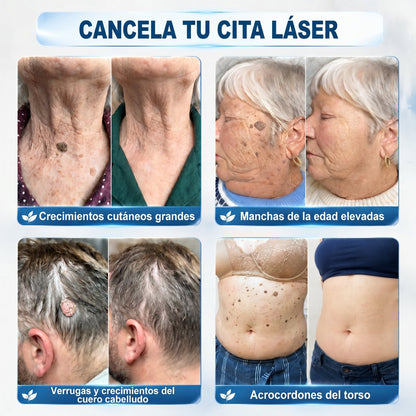 𝐏𝐢𝐜𝐝𝐨® 🌲🌲 Borrador de Verrugas y Manchas en 7 Días (𝐀𝐩𝐥𝐢𝐜𝐚𝐝𝐨𝐫 𝐫𝐨𝐥𝐥-𝐨𝐧: 𝐬𝐢𝐧 𝐝𝐨𝐥𝐨𝐫 𝐧𝐢 𝐜𝐢𝐜𝐚𝐭𝐫𝐢𝐜𝐞𝐬)✨